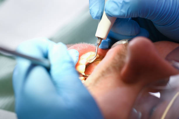 Best Emergency Tooth Extraction in Morgandale, OH
