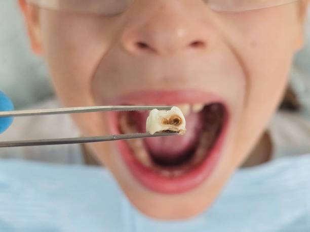 Best Emergency Gum Treatment in Morgandale, OH